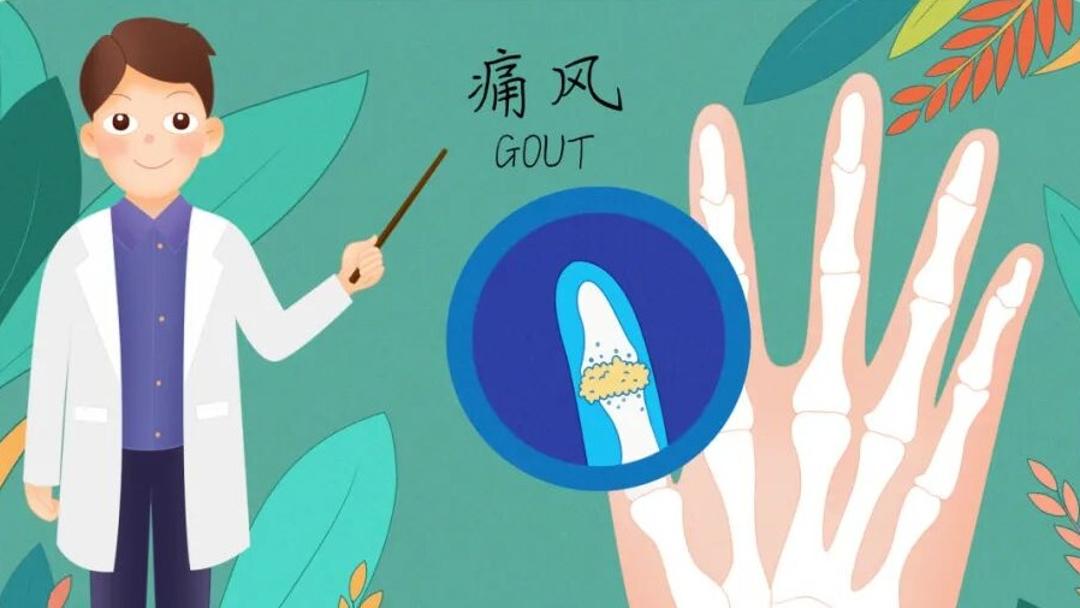 中国人民的好朋友为了友谊跨越山海